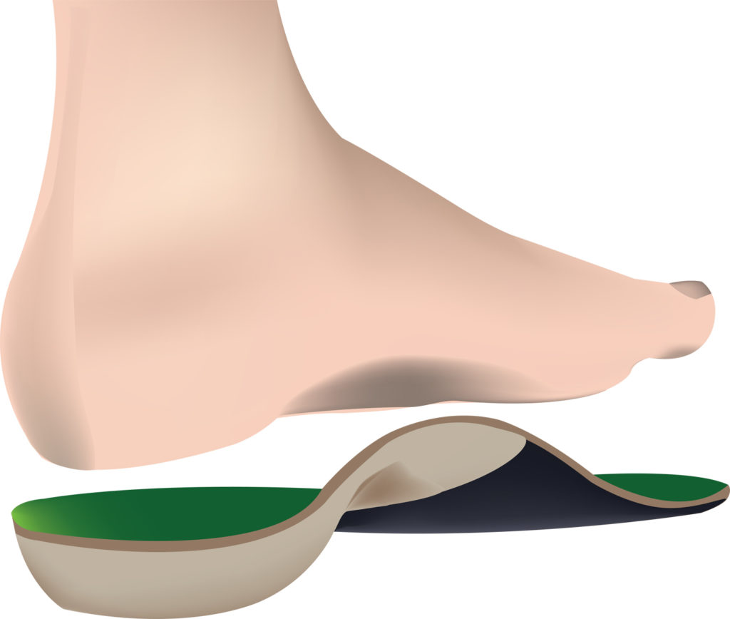 Helpen schoenen met anatomische inlegzolen bij voorkomen shin splints?
